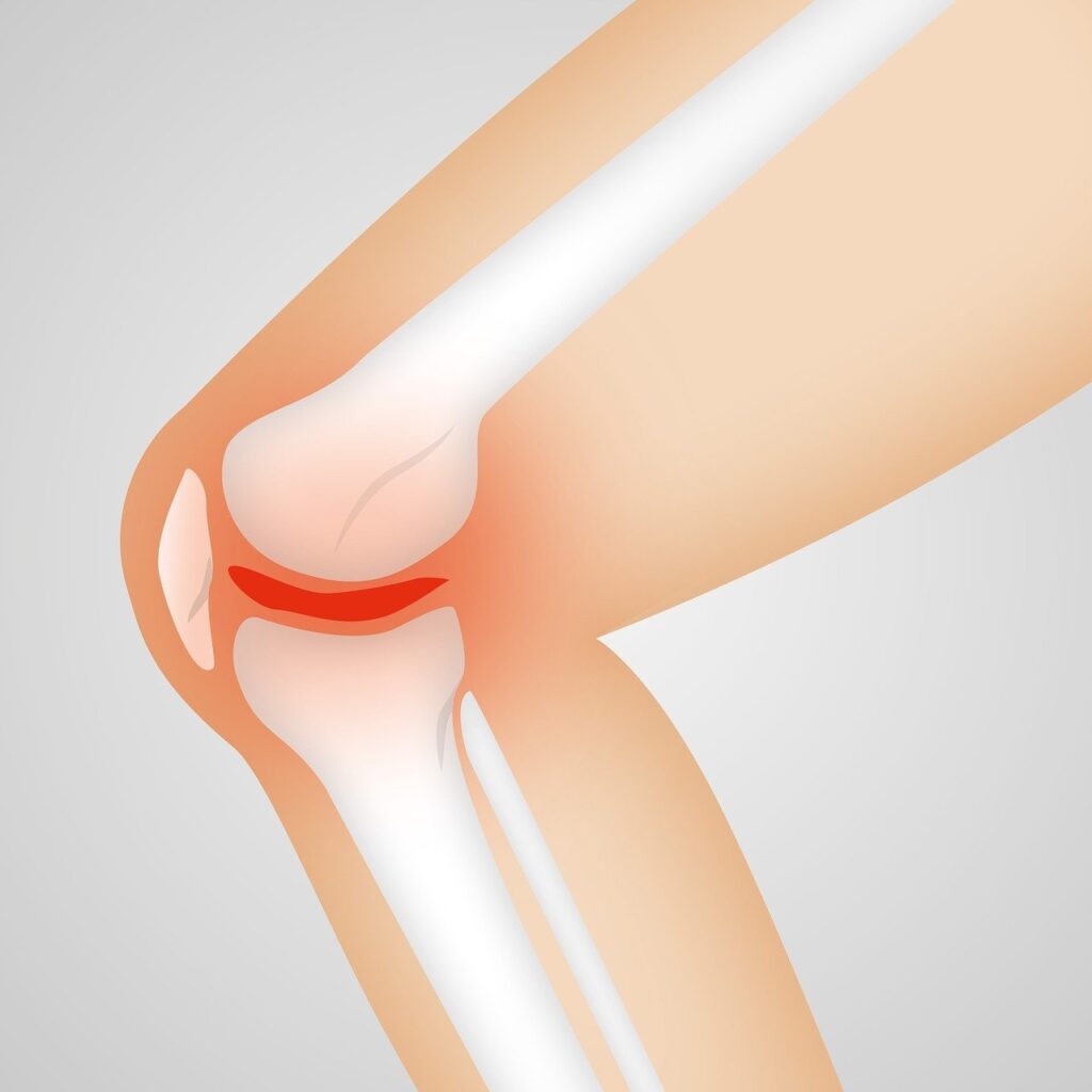 How Blood Flow Contributes to Knee Pain
