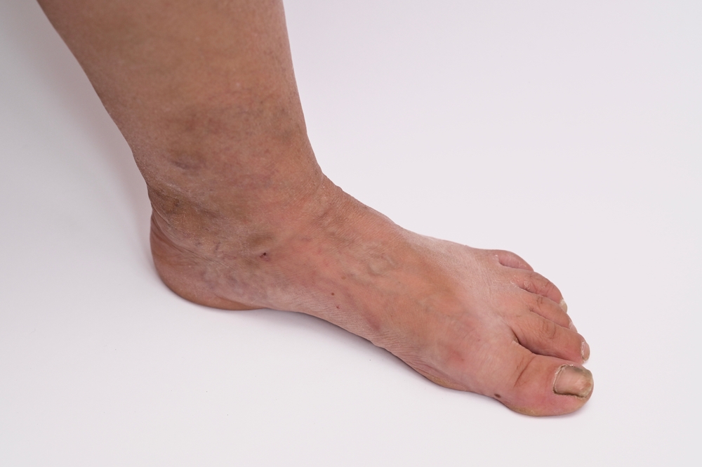 Best vein doctor near me