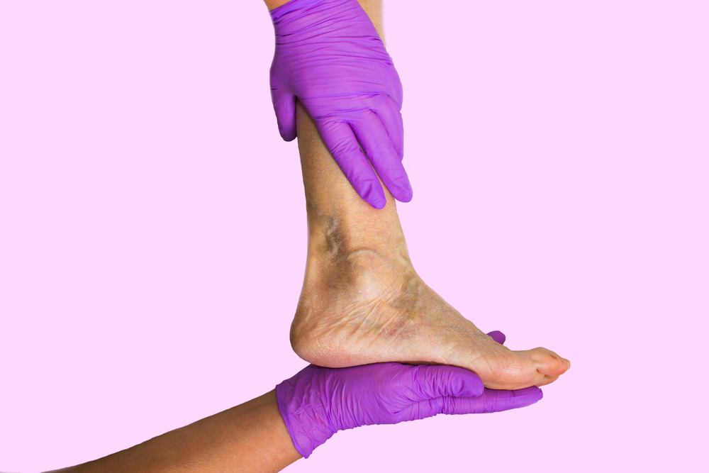 Best vein doctor near me