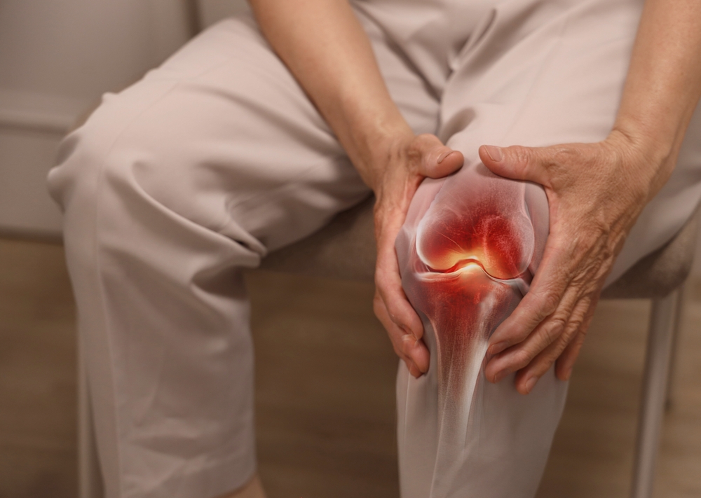 Best Non-Surgical Treatment for Knee Osteoarthritis