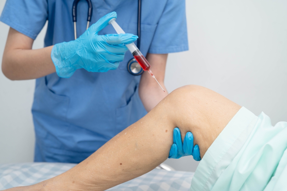 How to Treat Knee Osteoarthritis Without Surgery