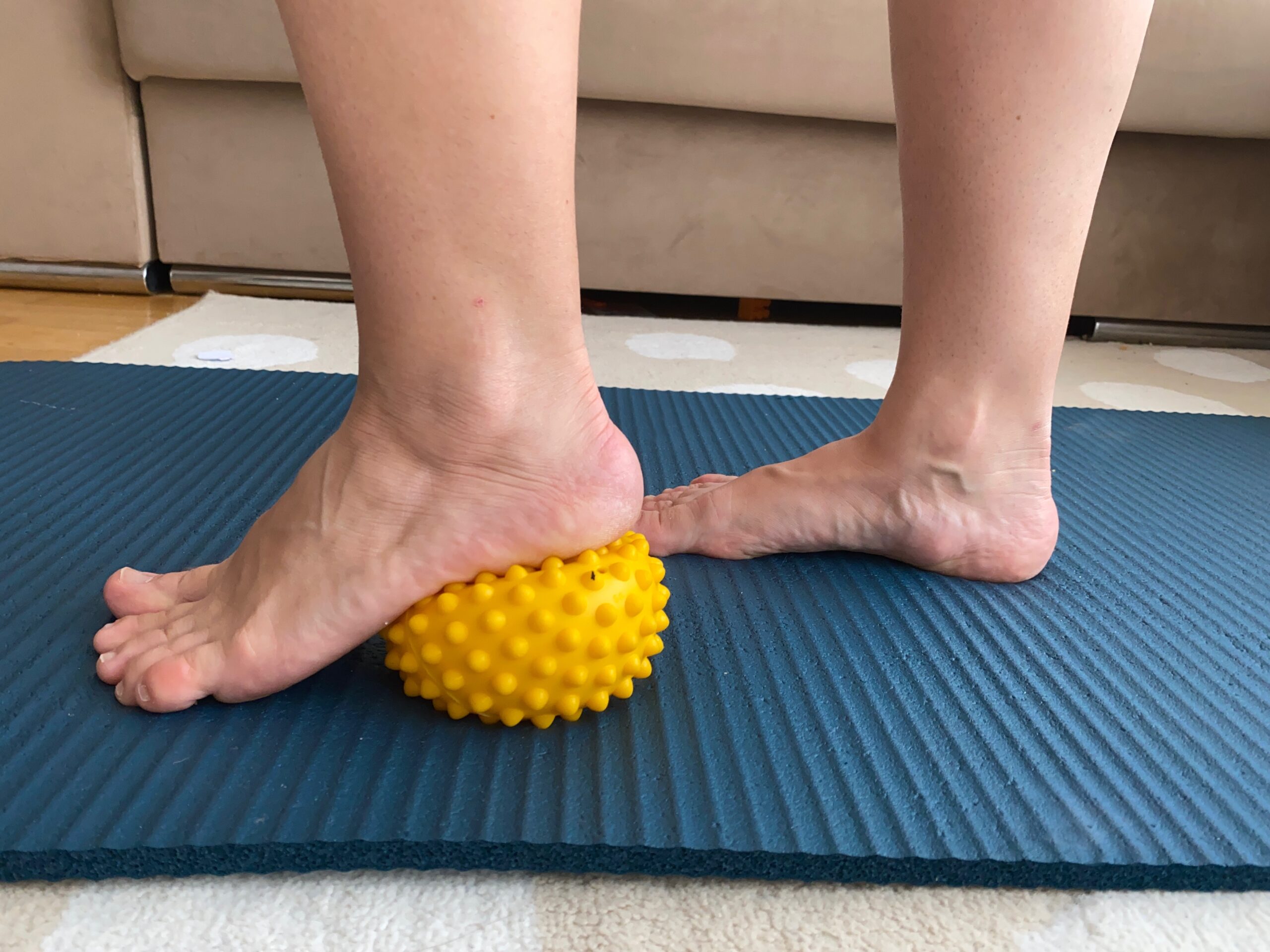5 Signs You May Be a Candidate for Plantar Fasciitis Embolization